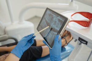 tooth-xray-5.jpeg
